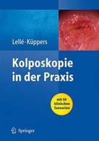 cover of the book Kolposkopie in der Praxis : mit 24 Tabellen