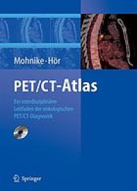 cover of the book PET-CT-Atlas : ein interdisziplinärer Leitfaden der onkologischen PET/CT-Diagnostik ; mit 15 Tabellen