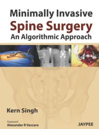 cover of the book Minimally Invasive Spine Surgery: An Algorithmic Approach