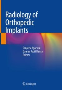 cover of the book Radiology of Orthopedic Implants