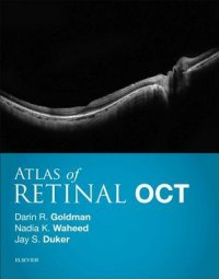 cover of the book Atlas of Retinal Oct E-Book: Optical Coherence Tomography