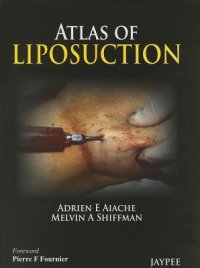 cover of the book Atlas of Liposuction