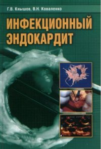 cover of the book Инфекционный эндокардит