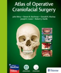 cover of the book Atlas of Operative Craniofacial Surgery