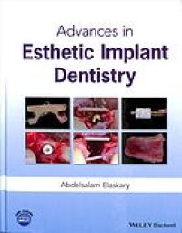 cover of the book Advances in esthetic implant dentistry