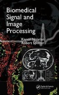 cover of the book Biomedical signal and image processing