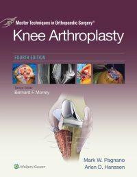 cover of the book Master Techniques in Orthopedic Surgery: Knee Arthroplasty