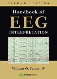 cover of the book Handbook of EEG Interpretation