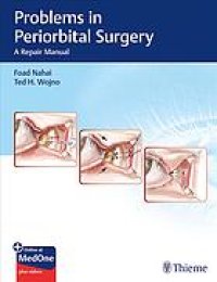 cover of the book Problems in periorbital surgery : a repair manual