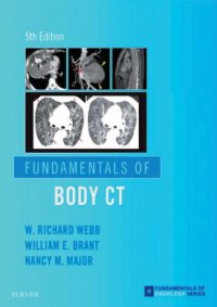 cover of the book Fundamentals of Body CT