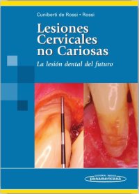 cover of the book Lesiones Cervicales no Cariosas