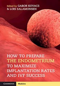 cover of the book How to Prepare the Endometrium to Maximize Implantation Rates and IVF Success