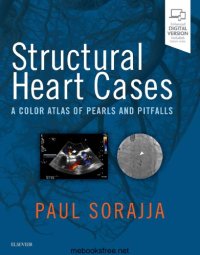 cover of the book Structural Heart Cases: A Color Atlas of Pearls and Pitfalls