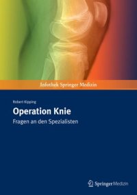 cover of the book Operation Knie: Fragen an den Spezialisten