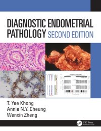 cover of the book Diagnostic endometrial pathology