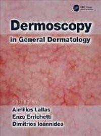 cover of the book Dermoscopy in general dermatology