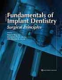 cover of the book Fundamentals of implant dentistry, Volume II Surgical Principles