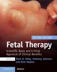 cover of the book Fetal Therapy: Scientific Basis and Critical Appraisal of Clinical Benefits