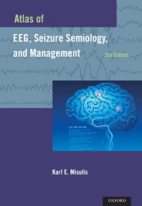 cover of the book Atlas of EEG, Seizure Semiology, and Management