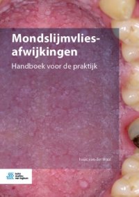 cover of the book Mondslijmvliesafwijkingen: Handboek voor de praktijk