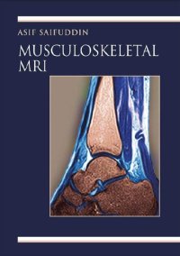 cover of the book Musculoskeletal MRI