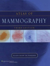 cover of the book Atlas of mammography