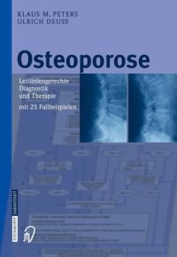 cover of the book Osteoporose : leitliniengerechte Diagnostik und Therapie mit 25 Fallbeispielen ; mit 35 Tabellen