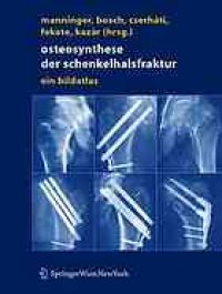 cover of the book Osteosynthese der schenkelhalsfraktur : ein bildatlas