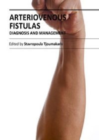 cover of the book Arteriovenous Fistulas: Diagnosis and Management