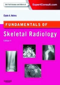 cover of the book Fundamentals of Skeletal Radiology