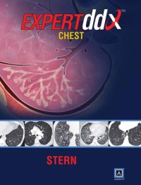 cover of the book EXPERTddx: Chest