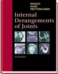 cover of the book Internal Derangements of Joints