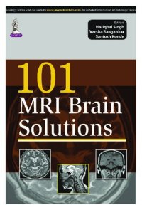 cover of the book Singh, H: 101 MRI Brain Solutions