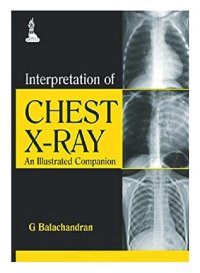 cover of the book Interpretation of Chest X-Ray: An Illustrated Companion