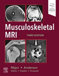 cover of the book Musculoskeletal MRI