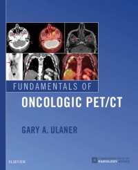 cover of the book Fundamentals of Oncologic PET/CT