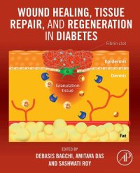 cover of the book Wound Healing, Tissue Repair, and Regeneration in Diabetes