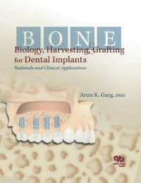 cover of the book Bone Biology, Harvesting and Grafting for Dental Implants: Rationale and Clinical Applications