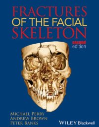 cover of the book Fractures of the Facial Skeleton