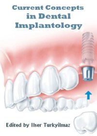 cover of the book Current Concepts in Dental Implantology