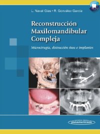 cover of the book Reconstrucción maxilomandibular compleja. Microcirugía, distracción ósea e implantes