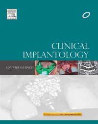 cover of the book Clinical Implantology, 1e