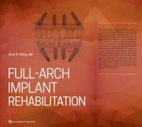 cover of the book Full-Arch Implant Rehabilitation