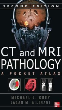 cover of the book CT & MRI pathology : a pocket atlas