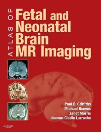 cover of the book Atlas of Fetal and Postnatal Brain MR