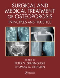 cover of the book Surgical and Medical Treatment of Osteoporosis: Principles and Practice