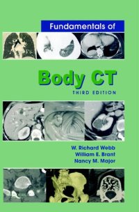 cover of the book Fundamentals of Body CT, 3e