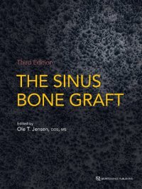 cover of the book The sinus bone graft