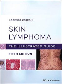 cover of the book Skin Lymphoma: The Illustrated Guide