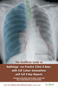 cover of the book The Unofficial Guide to Radiology: 100 Practice Chest X-Rays, with Full Colour Annotations and Full X-Ray Reports